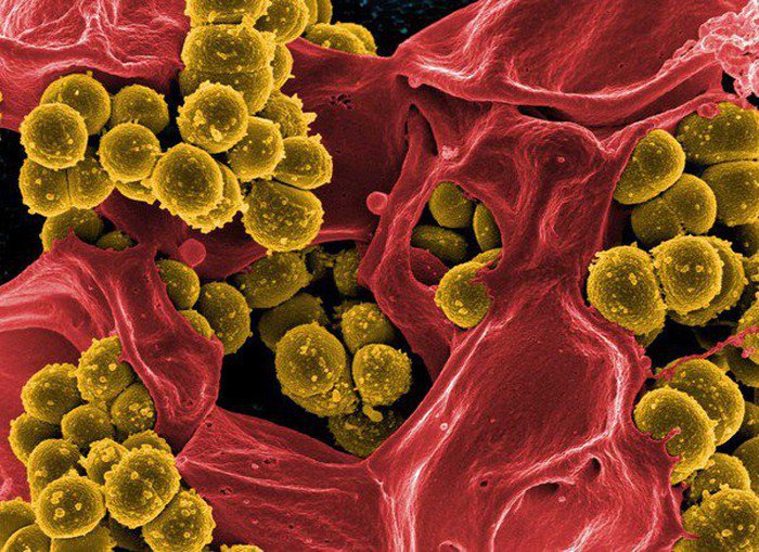 S. aureus là vi khuẩn Gram (+)